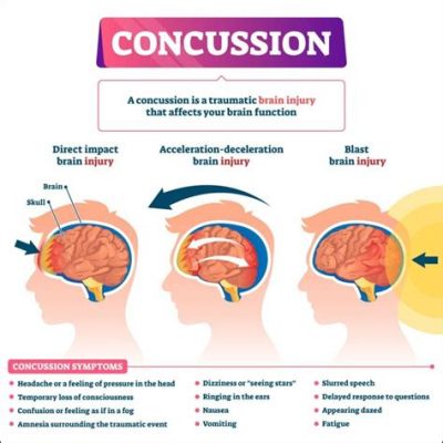 Can You Listen to Music with a Concussion? A Detailed Analysis